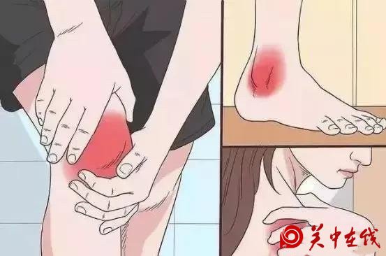 出现这三点，说明尿酸已经高的可怕！做到“三多四少”降尿酸！