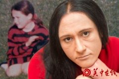 真人版睡美人 36岁女子一天睡眠长达21个小时